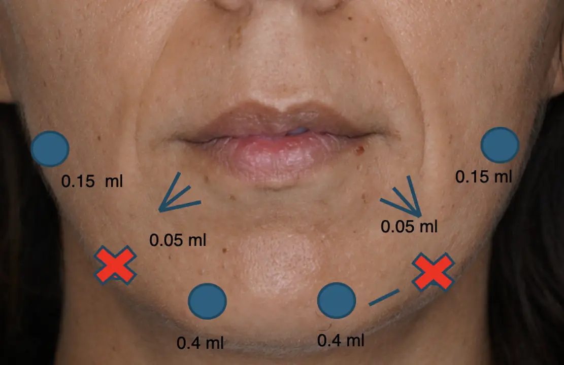EIMEC SCIENTIFIC DRA MEDINA tecnicas combinadas de Medicina Estetica facial